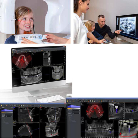 Томограф I-Max 3D 